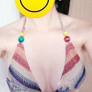 廣元美華楊林醫(yī)生做的自體脂肪隆胸，兩個月的果圖片分享~